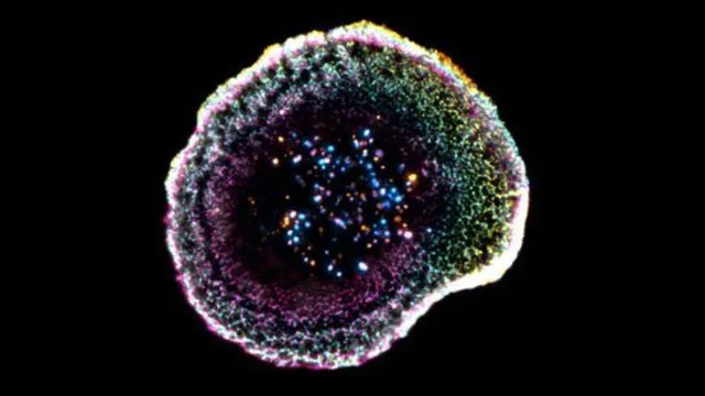 3D Imaging Reveals T Cell Kill Mechanism