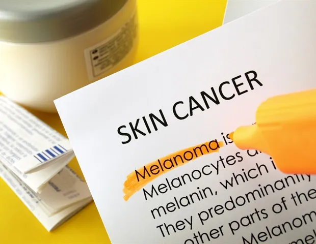 L'IA améliore la détection précoce du carcinome basocellulaire