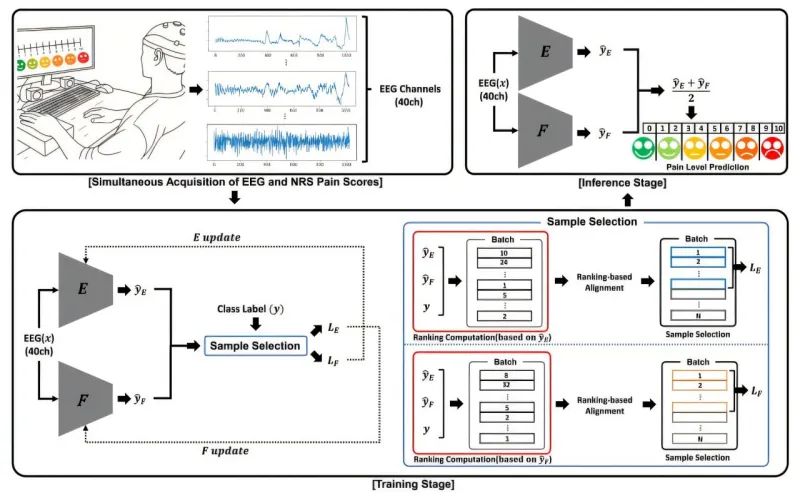 AI Uses Brain Waves to Objectively Assess Pain