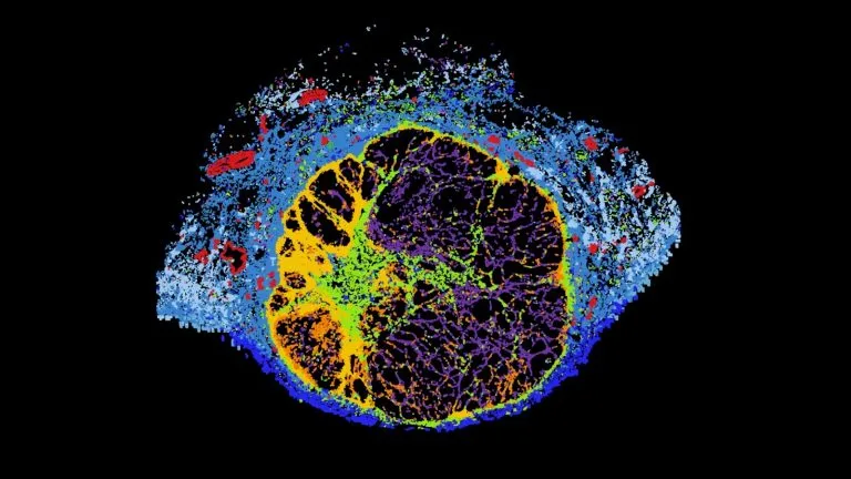 Blood Test Reveals Tumor Cell Neighborhoods, Predicts Immunotherapy Response