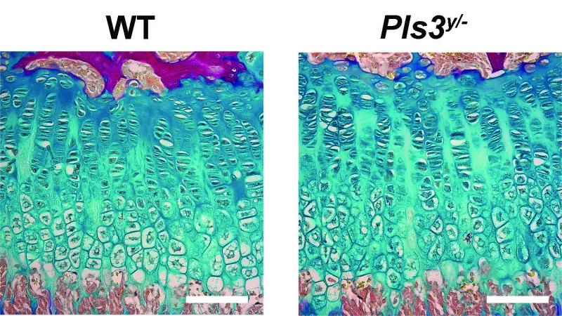 Blood Vessel Cells Key to Bone Healing in New Study