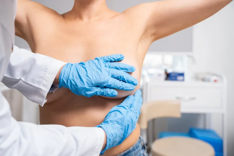 BRCA Testing Gaps Persist Despite Guidelines