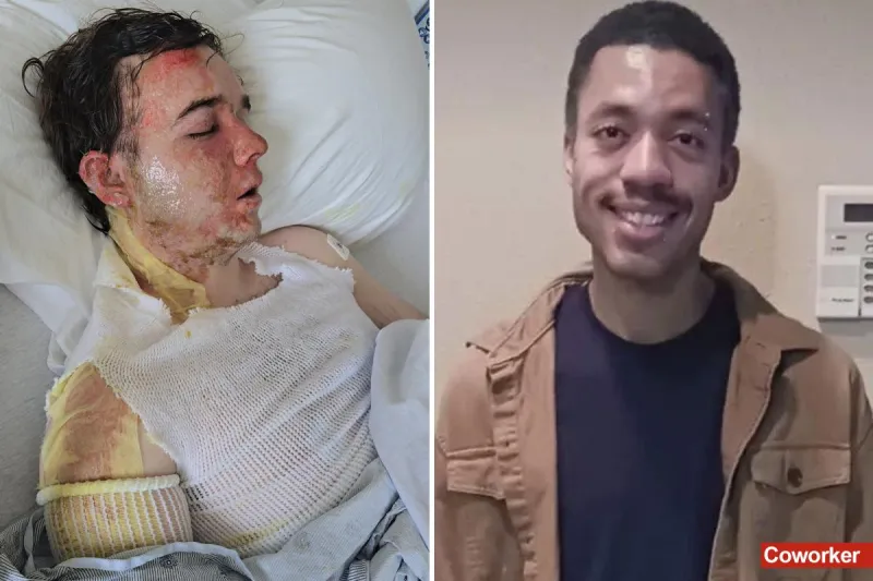 California McDonald's manager speaks after hot oil attack