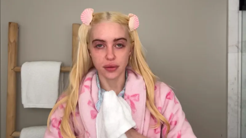 Chloe Cherry Discusses Lip Fillers and Botox Use