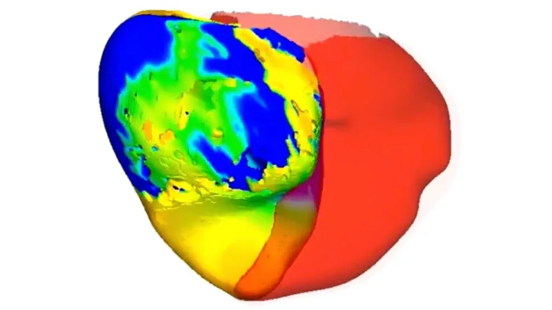 Des 'jumeaux' numériques du cœur guident le traitement des arythmies