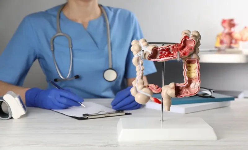 Early-Onset Colorectal Cancer Risk Factors Identified