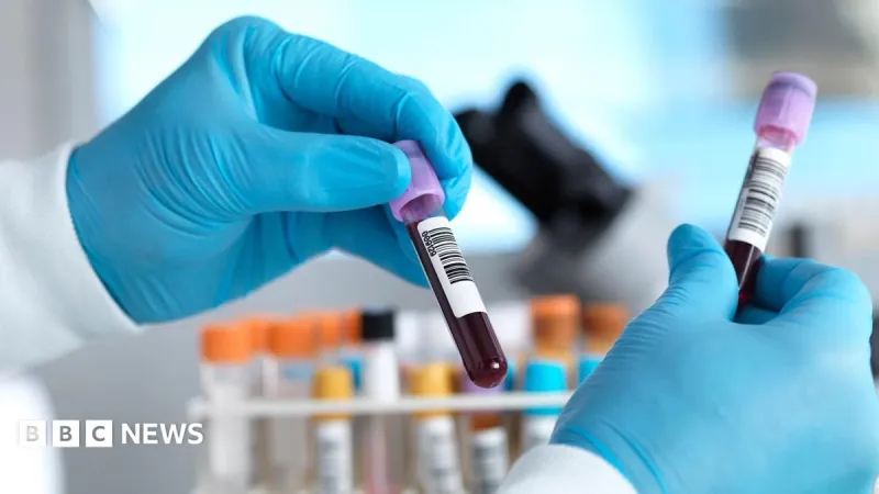 England on Track to Eliminate Hepatitis C
