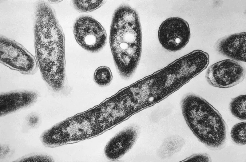 First Death in NYC Legionnaires' Outbreak Confirmed
