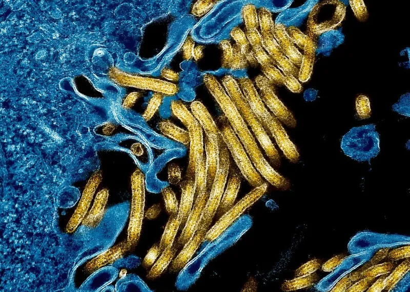 France Confirms Ebola Case in Doctor from Congo