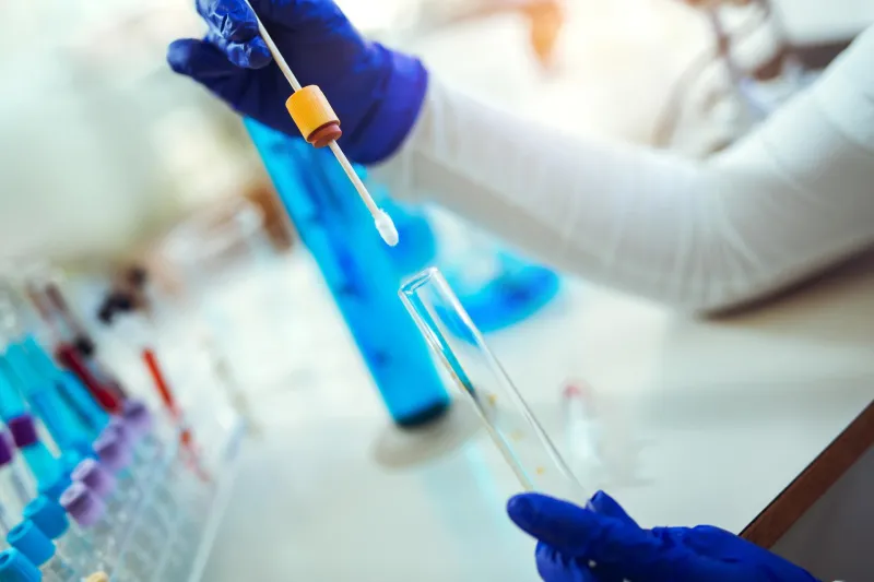 GCLA urges use of accredited lab services in Tanzania