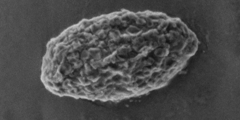 Glycogen Phosphatase Role in Lafora Disease Metabolism