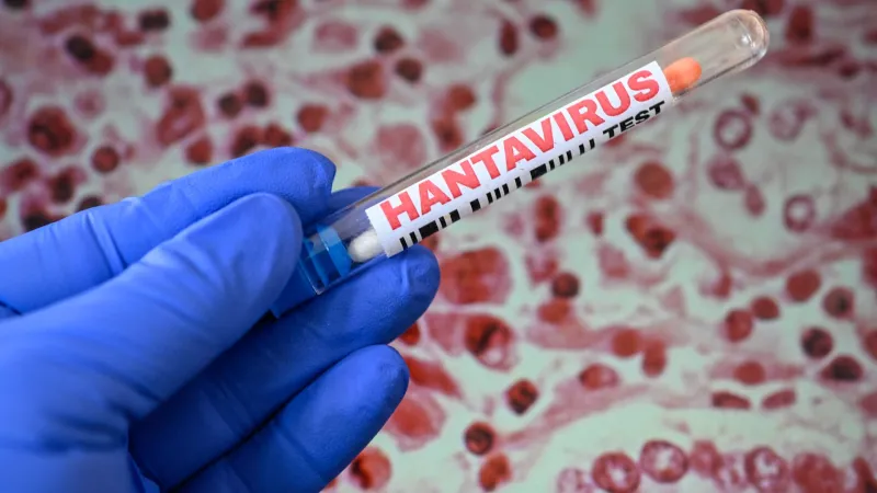 Hantavirus Outbreak Boosts Pharma Stocks