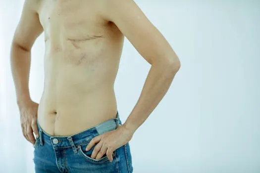 Hernia Awareness: Body Positivity and Surgery Options
