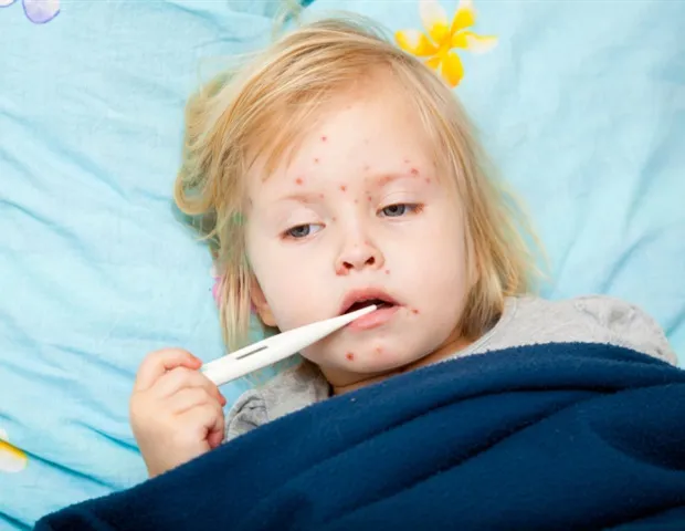Human Antibodies Neutralize Measles Virus, LJI Study Finds