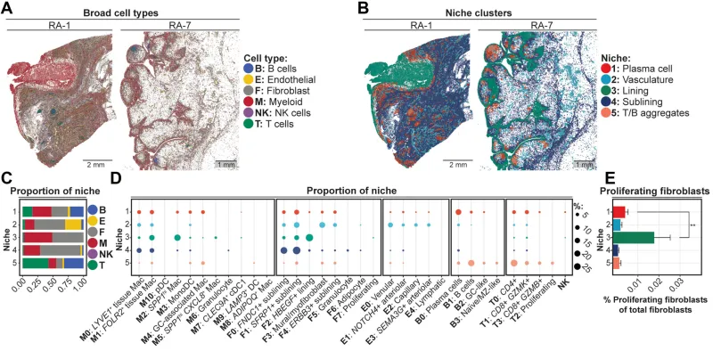 Cellules immunitaires stimulent la croissance articulaire dans la PR