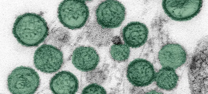Kenya boosts screening after Hantavirus cruise ship case