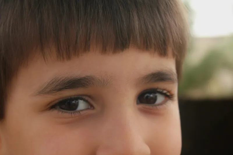 Low-dose atropine safe for child myopia, UK trial finds
