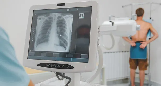 Un dépistage pulmonaire détecte 31 cancers en un an