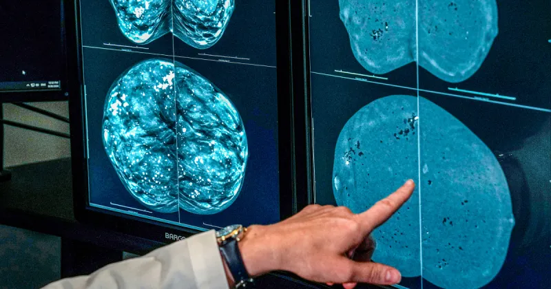 Mammogram Guidelines: Age 40 vs 50 Confusion