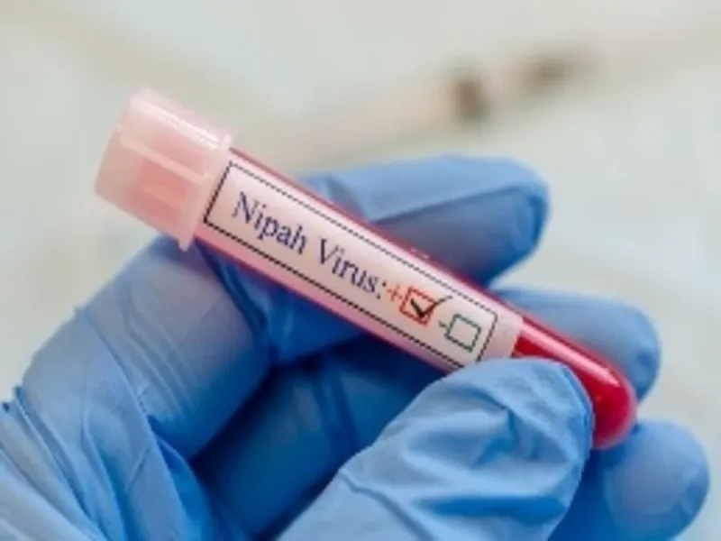 Nipah Virus Confirmed in Kozhikode Man