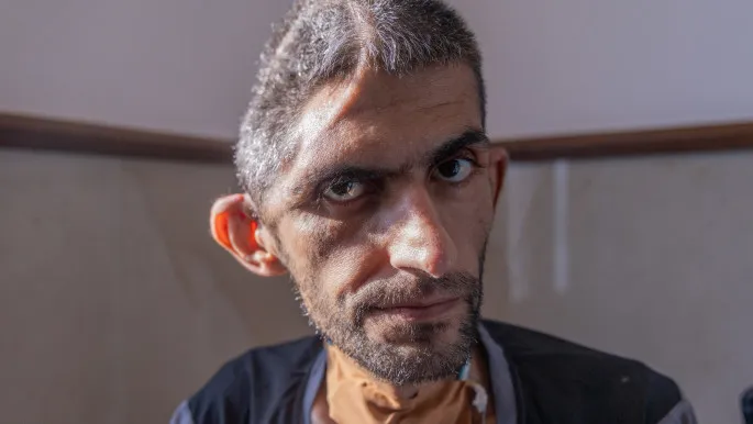 Palestinian recounts abuse in Israeli prison