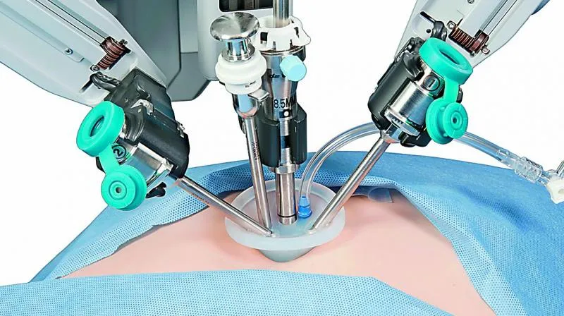 Robotic Surgery Low Complication in Endometriosis Study