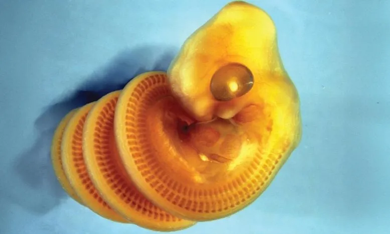 Snake Embryos Coil Right Due to Gut-Body Mismatch