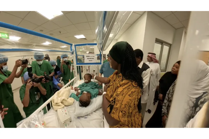 Tanzanian conjoined twins separated in Riyadh